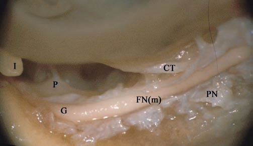 Fig. 4.75