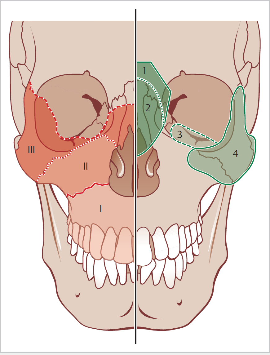 Surgical Anatomy Of The Paranasal Sinus Ento Key