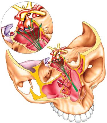 Endoscopic Approaches to the Anterior Skull Base | Ento Key