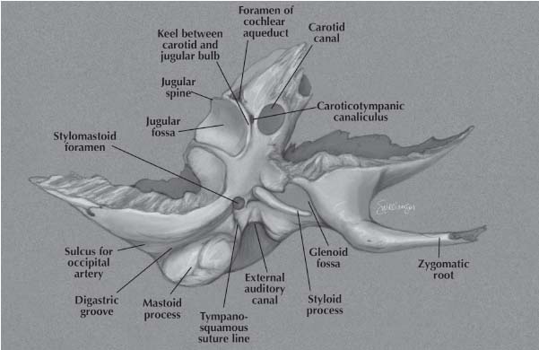 Anatomy Of The Temporal Bone Ento Key