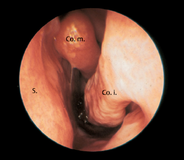 Fig. 2.6