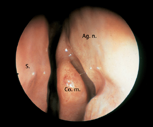 Fig. 2.8