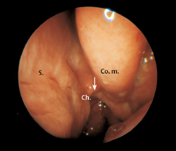 Fig. 2.11