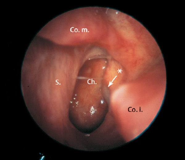 Fig. 2.13