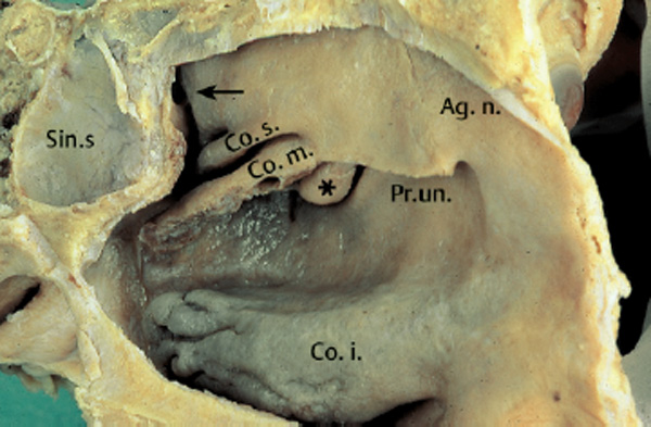 Fig. 2.14