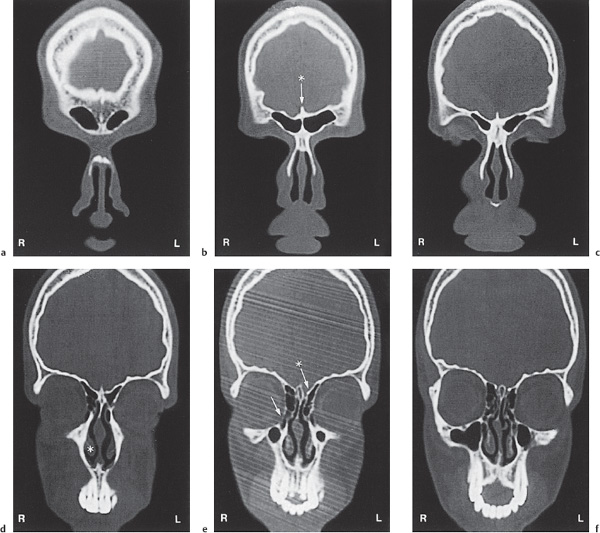 Fig. 2.22