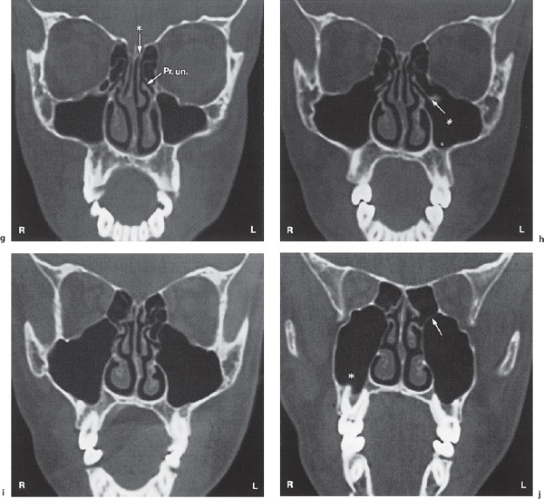 Fig. 2.22