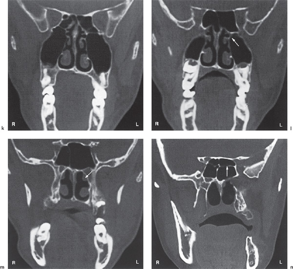 Fig. 2.22