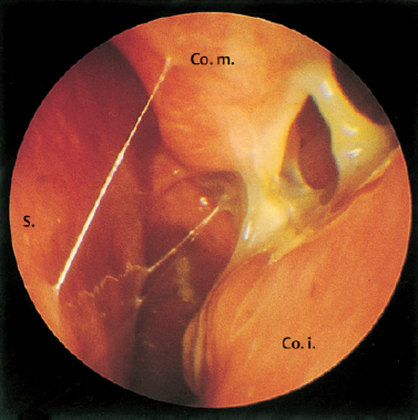 Fig. 3.1