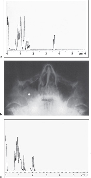 Fig. 3.4