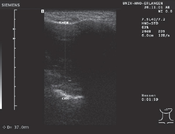 Fig. 3.5