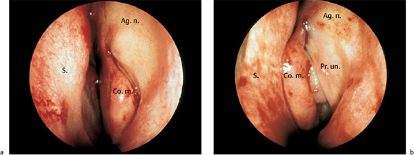 Fig. 6.8