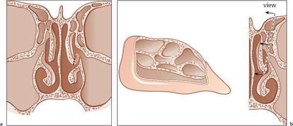 Fig. 6.9