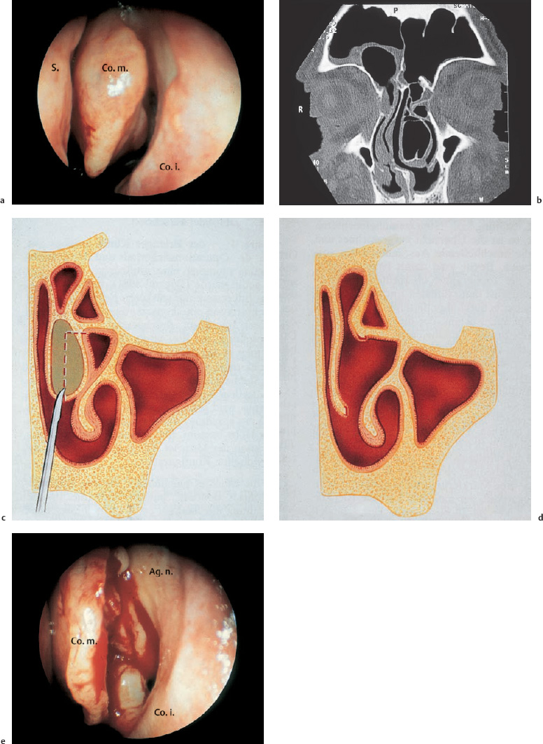 Fig. 6.12