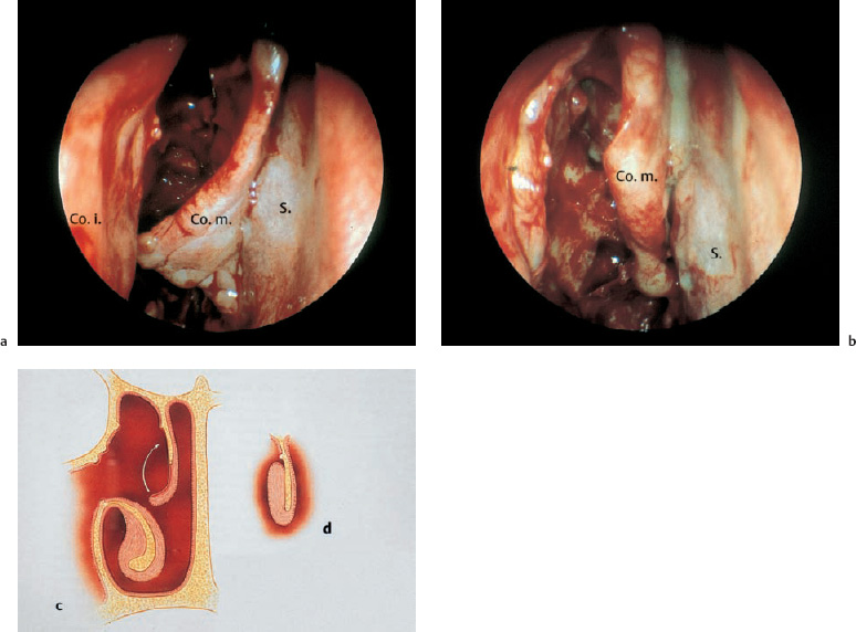 Fig. 6.14