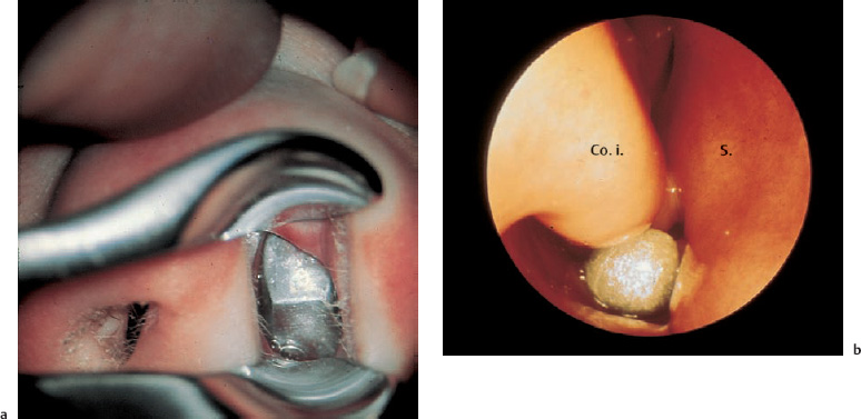 Fig. 6.15