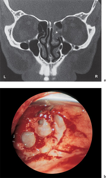 Fig. 6.22