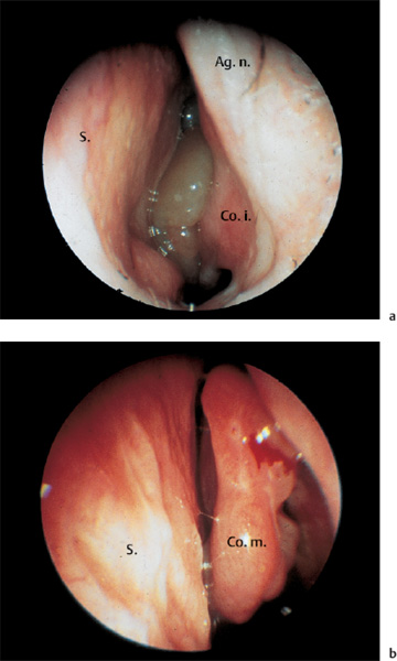 Fig. 6.24