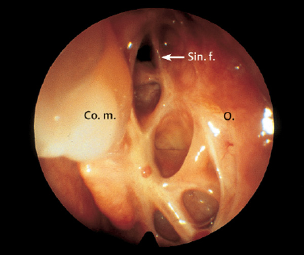 Fig. 6.26