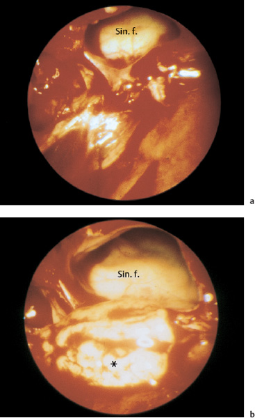 Fig. 6.27