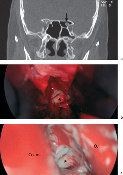 Fig. 6.37