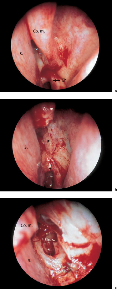 Fig. 6.39