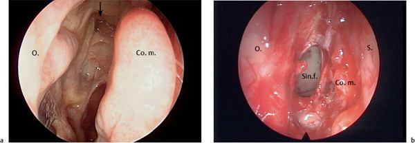 Fig. 8.1 a, b