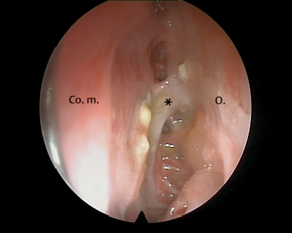 Fig. 8.2