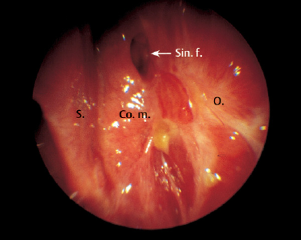 Fig. 8.3