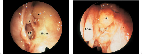 Fig. 8.5a