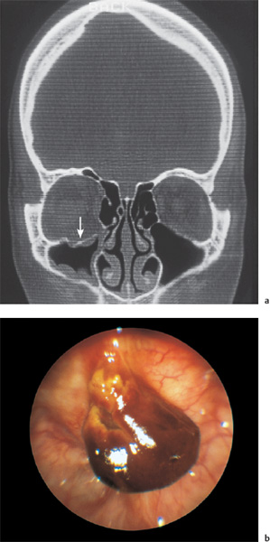 Fig. 9.7 a, b