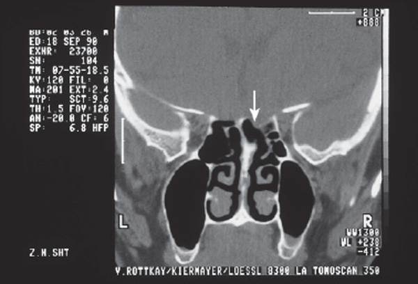 Fig. 9.12