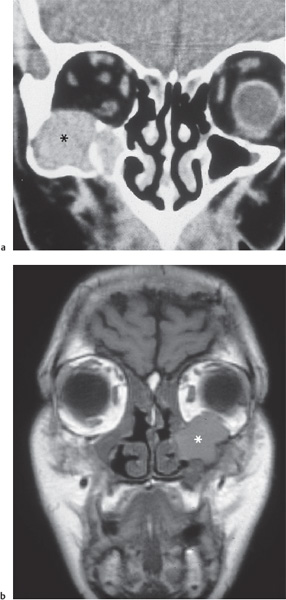 Fig. 11.1 a, b