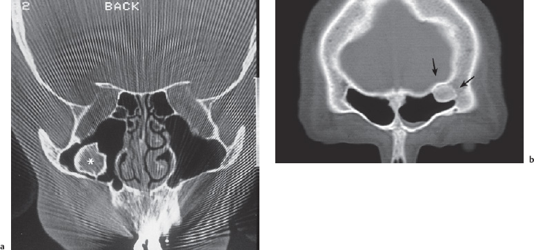 Fig. 11.7 a, b