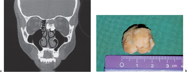 Fig. 11.10 a, b