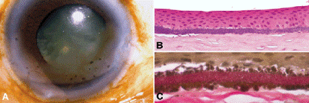 Cornea and Sclera | Ento Key