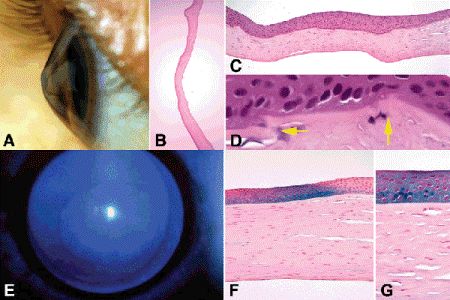 Cornea and Sclera | Ento Key