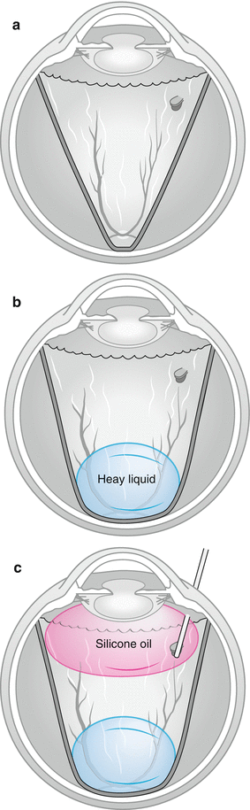 A140785_2_En_8_Fig25_HTML.gif