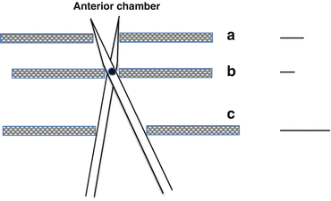 A333095_1_En_13_Fig2_HTML.gif