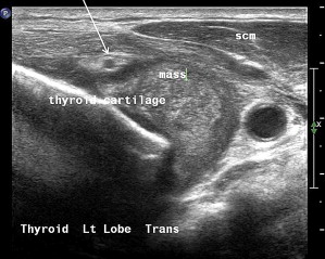 Interpretation of Ultrasound | Ento Key