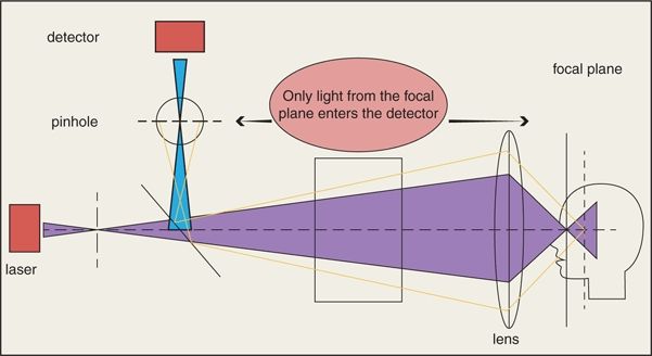 Fundus Autofluorescence Imaging In Age-Related Macular Degeneration ...