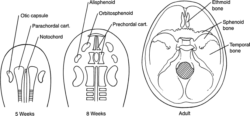 Congenital Craniofacial Deformities: Ophthalmologic Considerations ...