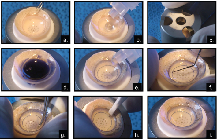 Eye Bank Preparation Of Endothelial Keratoplasty Grafts | Ento Key