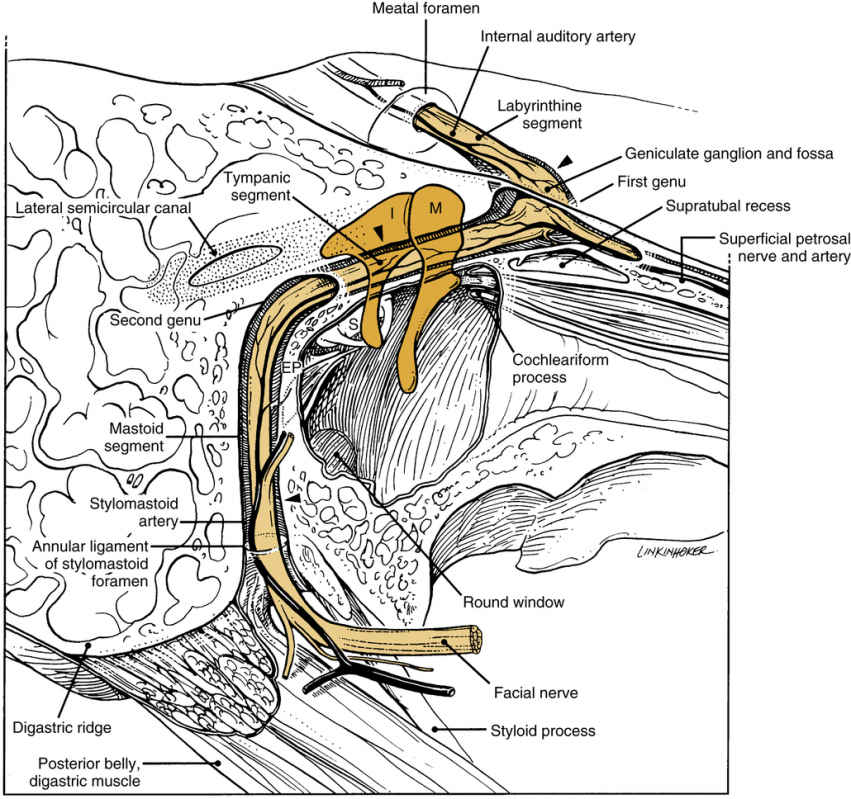 Otology And Neurotology | Ento Key