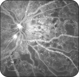 Fundus | Ento Key