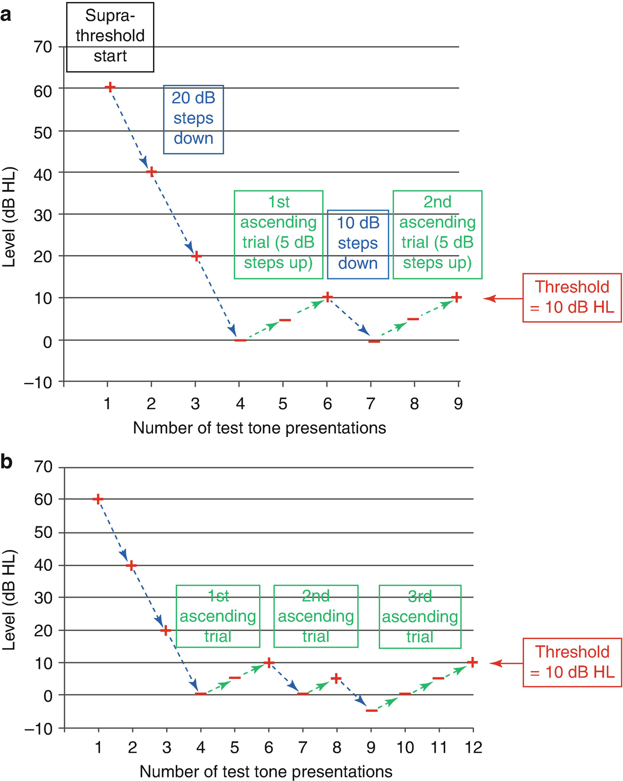 And Differential Diagnosis Of Disorders Of Hearing Development | Ento Key