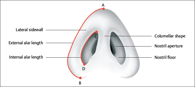 Chapter 9 Alar Reduction And Sculpture | Ento Key