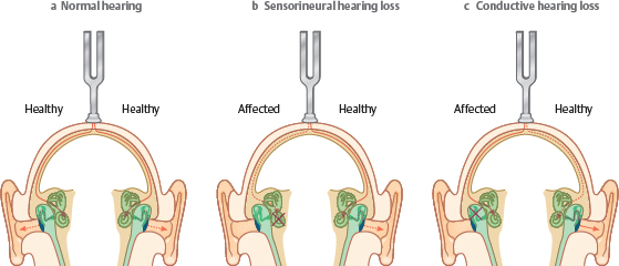 3.4 Audiology | Ento Key