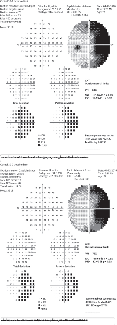 Chapter 4 Neuro-Ophthalmology | Ento Key