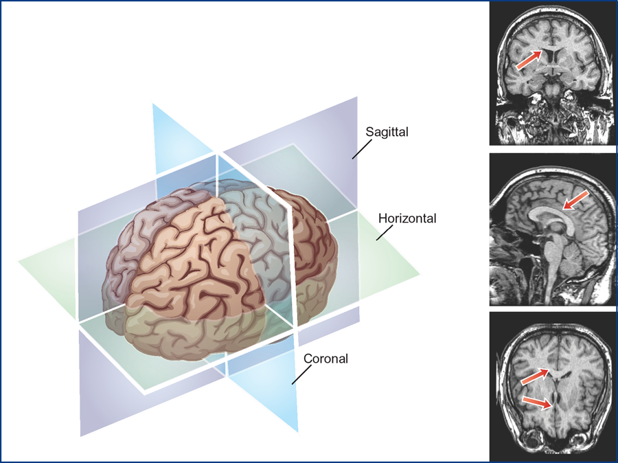 Neural Structures And Mechanisms For Speech, Language, And Hearing ...